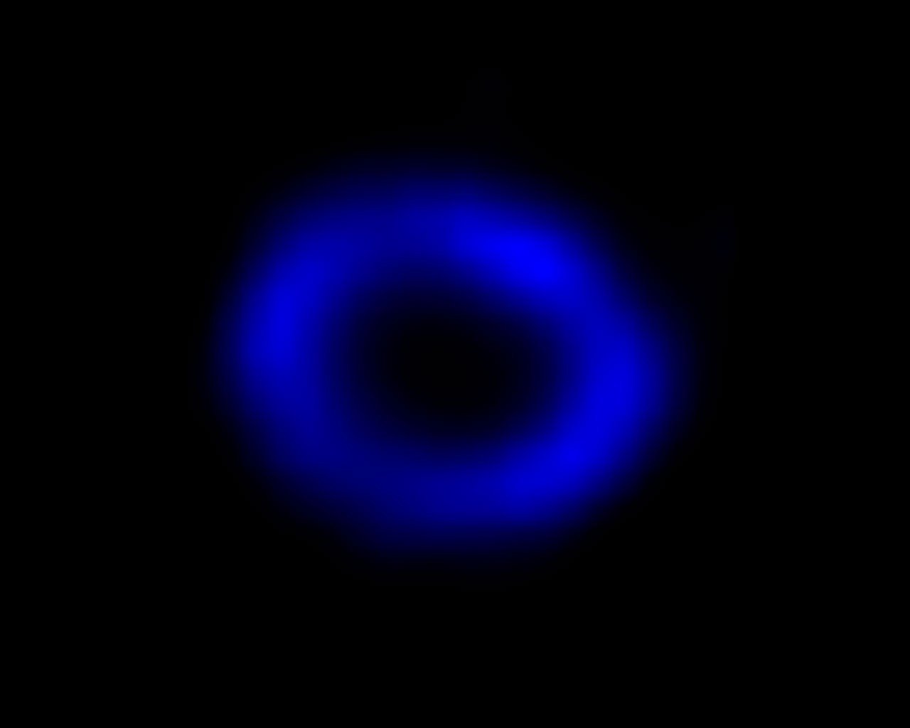 SN 1987A hot gas in Chandra X-ray observations